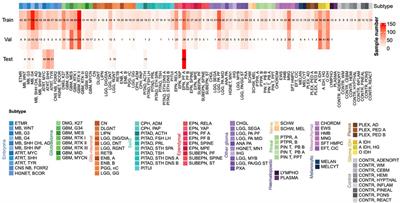 Development of a Machine Learning Classifier for Brain Tumors Diagnosis Based on DNA Methylation Profile